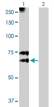 Western blot - Anti-MGAT3 antibody (AB103427)