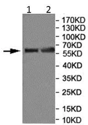 Western blot - Anti-MGAT4B antibody (AB177206)