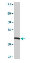 Western blot - Anti-MGAT5 antibody [3E9] (AB87977)