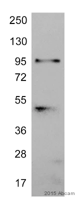 Western blot - Anti-MGAT5 antibody [3E9] (AB87977)