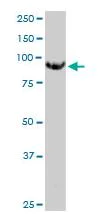 Western blot - Anti-MGAT5 antibody [3E9] (AB87977)