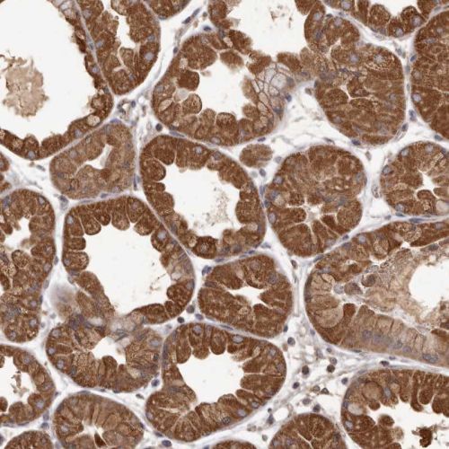 Immunohistochemistry (Formalin/PFA-fixed paraffin-embedded sections) - Anti-MGAT5 antibody (AB244318)