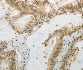 Immunohistochemistry (Formalin/PFA-fixed paraffin-embedded sections) - Anti-MGEA5/OGA antibody (AB197389)