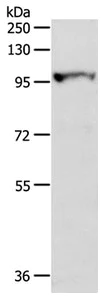 Western blot - Anti-MGEA5/OGA antibody (AB197389)