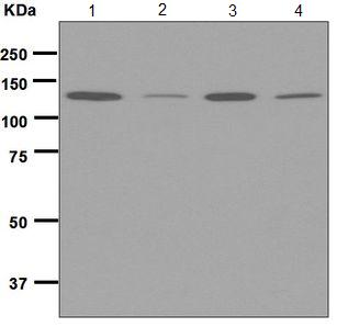 Western blot - Anti-MGEA5/OGA antibody [EPR7154(B)] (AB124807)