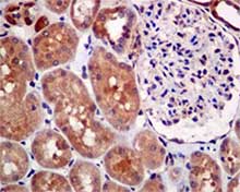Immunohistochemistry (Formalin/PFA-fixed paraffin-embedded sections) - Anti-MGEA5/OGA antibody [EPR7154(B)] - BSA and Azide free (AB227989)