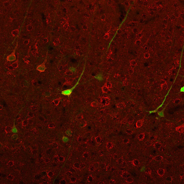Immunohistochemistry (PFA perfusion fixed frozen sections) - Anti-mGluR1 antibody (AB153669)