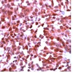 Immunohistochemistry (Formalin/PFA-fixed paraffin-embedded sections) - Anti-mGluR1 antibody (AB27199)