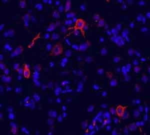 Immunocytochemistry/ Immunofluorescence - Anti-mGluR1 antibody (AB82211)