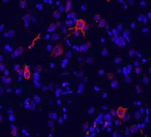 Immunocytochemistry/ Immunofluorescence - Anti-mGluR1 antibody (AB82211)
