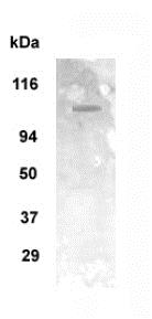 Anti-mGluR1 antibody