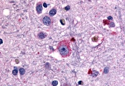 Immunohistochemistry (Formalin/PFA-fixed paraffin-embedded sections) - Anti-mGluR1 antibody - N-terminal (AB189058)