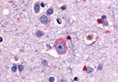 Immunohistochemistry (Formalin/PFA-fixed paraffin-embedded sections) - Anti-mGluR1 antibody - N-terminal (AB189058)