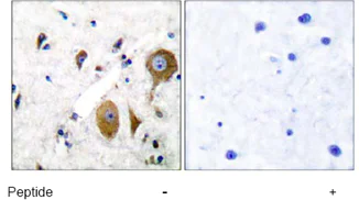 Immunohistochemistry (Formalin/PFA-fixed paraffin-embedded sections) - Anti-MGLUR8 antibody (AB53094)