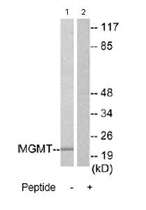 Western blot - Anti-MGMT antibody (AB69629)