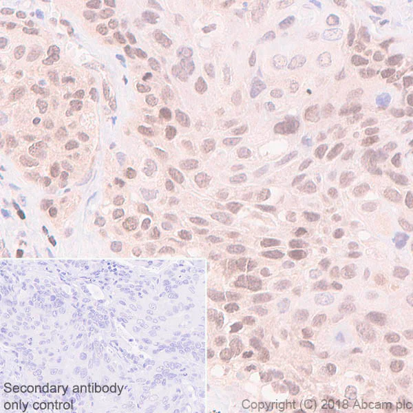 Immunohistochemistry (Formalin/PFA-fixed paraffin-embedded sections) - Anti-MGMT antibody [EPR4397] (AB108630)