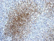 Immunohistochemistry (Formalin/PFA-fixed paraffin-embedded sections) - Anti-MGMT antibody [EPR4397] (AB108630)