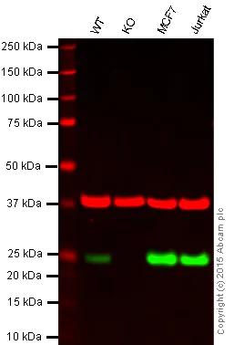 Western blot - Anti-MGMT antibody [EPR4397] (AB108630)