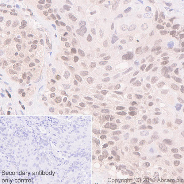Immunohistochemistry (Formalin/PFA-fixed paraffin-embedded sections) - Anti-MGMT antibody [EPR4397] - BSA and Azide free (AB233012), expandable thumbnail