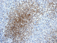Immunohistochemistry (Formalin/PFA-fixed paraffin-embedded sections) - Anti-MGMT antibody [EPR4397] - BSA and Azide free (AB233012), expandable thumbnail