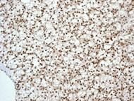 Immunohistochemistry (Formalin/PFA-fixed paraffin-embedded sections) - Anti-MGMT antibody [EPR4397] - BSA and Azide free (AB233012), expandable thumbnail
