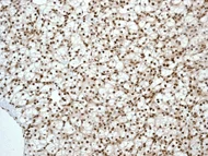 Immunohistochemistry (Formalin/PFA-fixed paraffin-embedded sections) - Anti-MGMT antibody [EPR4397] - BSA and Azide free (AB233012)