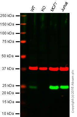Western blot - Anti-MGMT antibody [EPR4398] (AB108989)