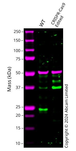 Western blot - Anti-MGMT antibody [EPR4398] (AB108989)