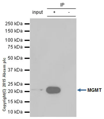 Immunoprecipitation - Anti-MGMT antibody [EPR4398] - BSA and Azide free (AB247735)