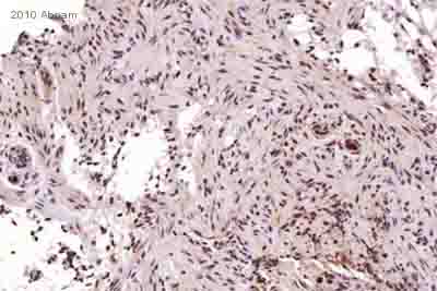 Immunohistochemistry (Formalin/PFA-fixed paraffin-embedded sections) - Anti-MGMT antibody [MT3.1] (AB39253), expandable thumbnail