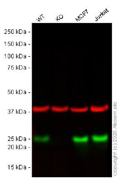Western blot - Anti-MGMT antibody [MT3.1] (AB39253), expandable thumbnail