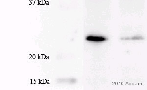 Western blot - Anti-MGMT antibody [MT3.1] (ab39253), expandable thumbnail