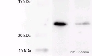 Western blot - Anti-MGMT antibody [MT3.1] (AB39253)