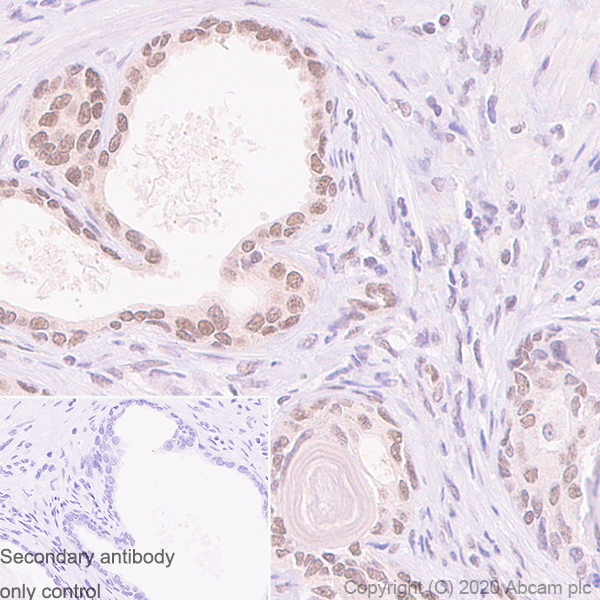 Immunohistochemistry (Formalin/PFA-fixed paraffin-embedded sections) - Anti-MGMT antibody [MT3.1] - BSA and Azide free (AB255966), expandable thumbnail