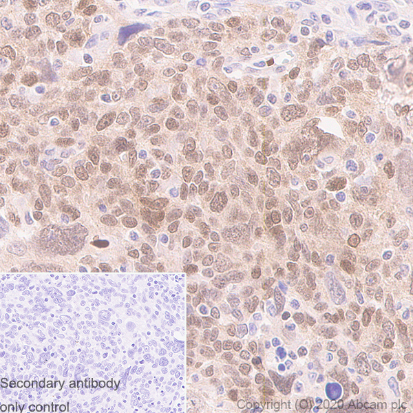 Immunohistochemistry (Formalin/PFA-fixed paraffin-embedded sections) - Anti-MGMT antibody [MT3.1] - BSA and Azide free (AB255966), expandable thumbnail
