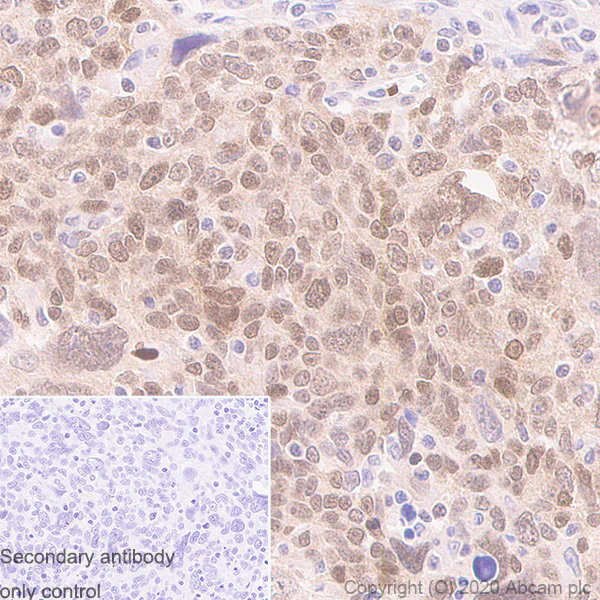 Immunohistochemistry (Formalin/PFA-fixed paraffin-embedded sections) - Anti-MGMT antibody [MT3.1] - BSA and Azide free (AB255966)