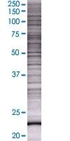 SDS-PAGE - MGMT overexpression 293T lysate (whole cell) (AB94051)