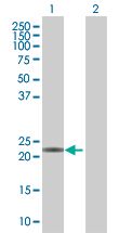 Western blot - MGMT overexpression 293T lysate (whole cell) (AB94051), expandable thumbnail