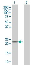 Western blot - MGMT overexpression 293T lysate (whole cell) (AB94051)