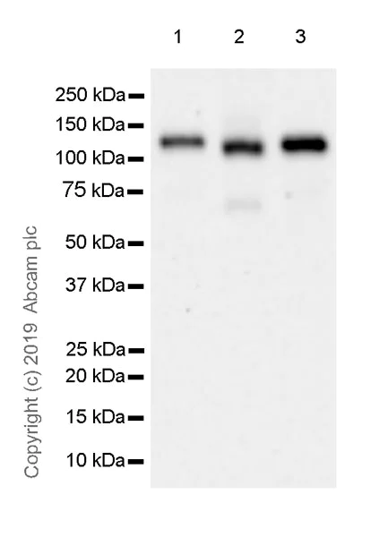 Western blot - MGMT overexpression 293T lysate (whole cell) (AB94051)