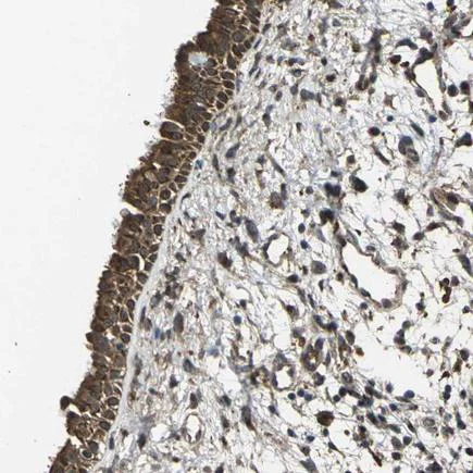 Immunohistochemistry (Formalin/PFA-fixed paraffin-embedded sections) - Anti-MGP antibody (AB224367)