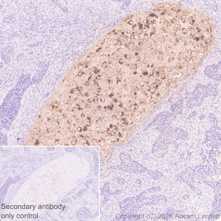 Immunohistochemistry (Formalin/PFA-fixed paraffin-embedded sections) - Anti-MGP antibody [EPR30430-17] (AB325749)