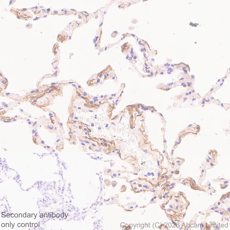 Immunohistochemistry (Formalin/PFA-fixed paraffin-embedded sections) - Anti-MGP antibody [EPR30430-17] (AB325749)