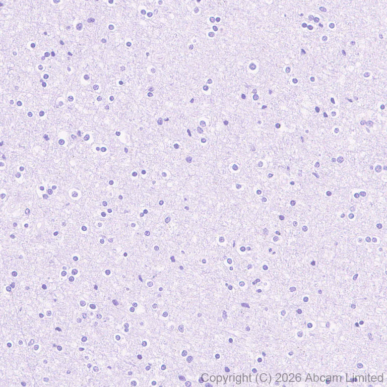 Immunohistochemistry (Formalin/PFA-fixed paraffin-embedded sections) - Anti-MGP antibody [EPR30430-17] (AB325749)