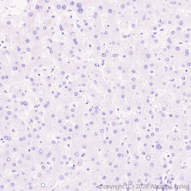 Immunohistochemistry (Formalin/PFA-fixed paraffin-embedded sections) - Anti-MGP antibody [EPR30430-17] (AB325749)
