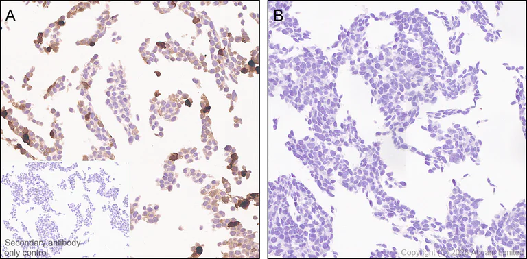 Immunohistochemistry (Formalin/PFA-fixed paraffin-embedded sections) - Anti-MGP antibody [EPR30430-17] (AB325749)