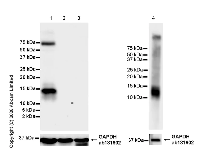Western blot - Anti-MGP antibody [EPR30430-17] (AB325749)