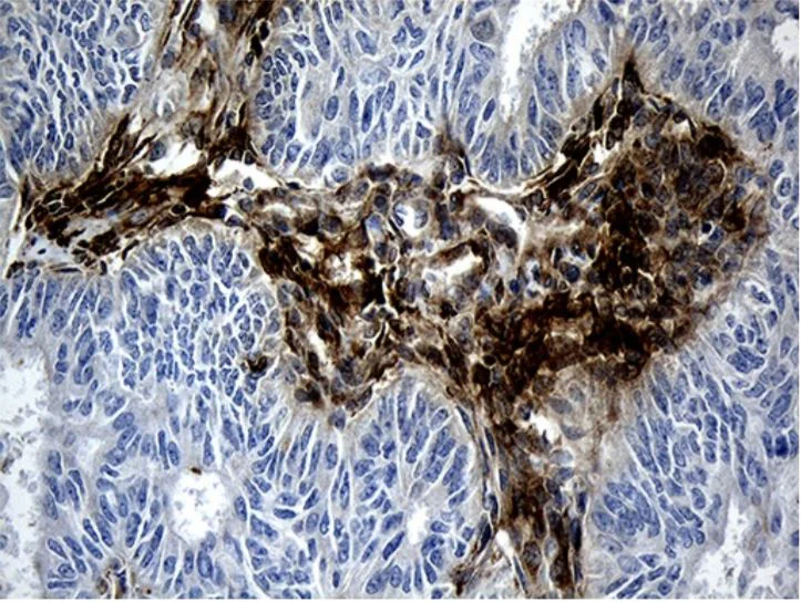 Immunohistochemistry (Formalin/PFA-fixed paraffin-embedded sections) - Anti-MGP antibody [OTI8D6] - BSA and Azide free (AB273657)