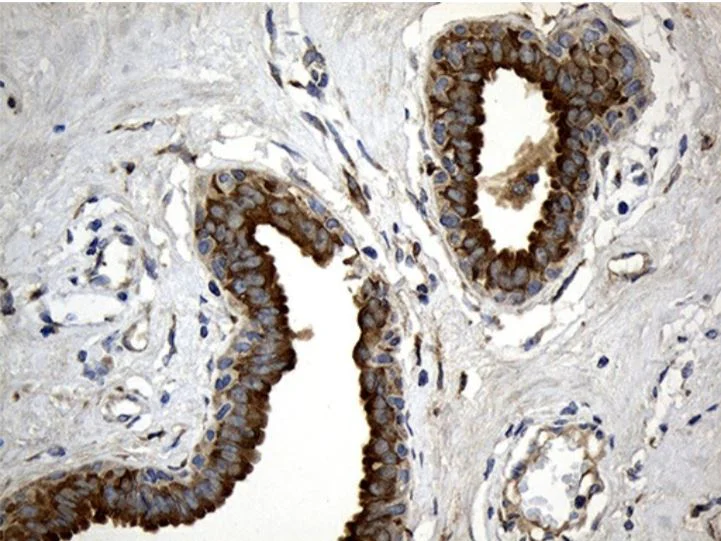 Immunohistochemistry (Formalin/PFA-fixed paraffin-embedded sections) - Anti-MGP antibody [OTI8D6] - BSA and Azide free (AB273657)