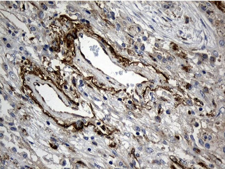 Immunohistochemistry (Formalin/PFA-fixed paraffin-embedded sections) - Anti-MGP antibody [OTI8D6] - BSA and Azide free (AB273657)